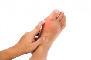 man with big toe joint arthritis