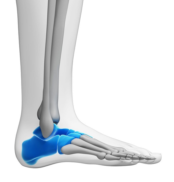 An overview of treatment for tarsal coalition