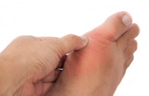 big toe joint arthritis pain
